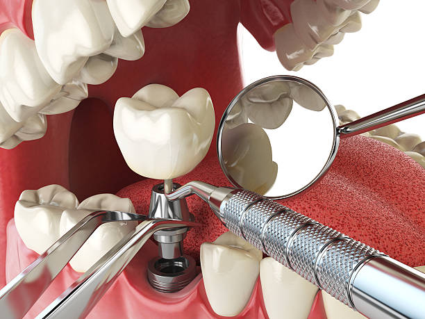 Best Emergency Care for Gum Disease in Alba, NY
